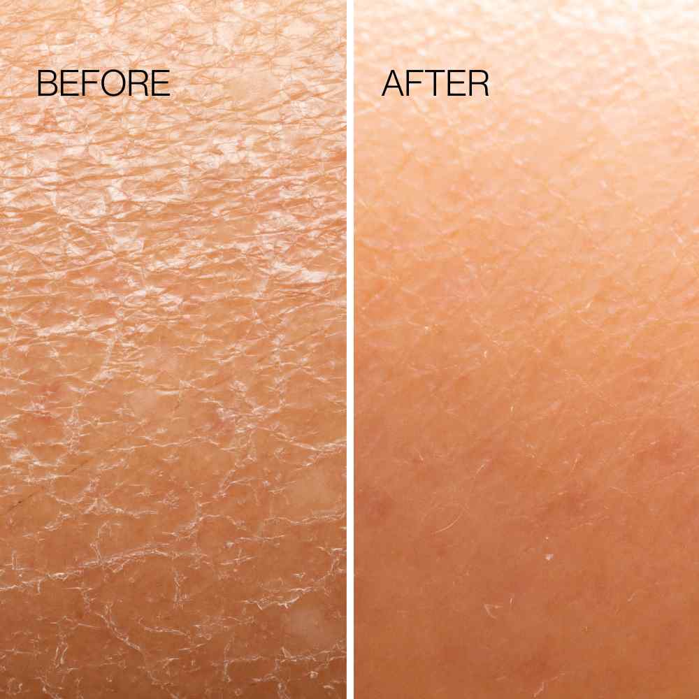 Body Exfoliation Tool
